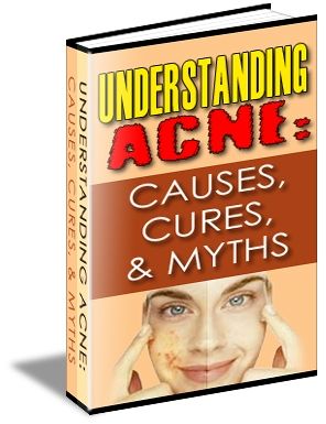 Understanding Acne: Causes, Cures & Myths - Click Image to Close